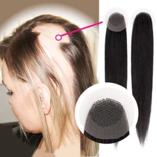 Full Lace Cover-up Tape Human Hair Patches Patch Hairpiece for Alopecia Areata