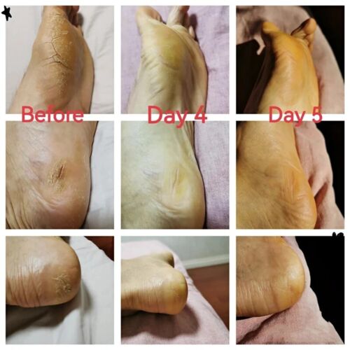 Herbal Anti Crack Foot Cream Oil Anti-Drying Moisturizing Feet Cream 85g - Picture 3 of 5