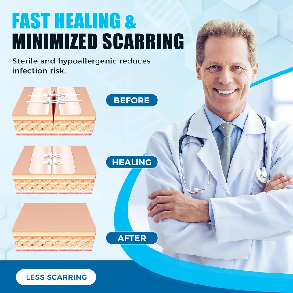 Butterfly Bandaids for Wound Closure, 2 Pcs Zip Stitch Wound Closure Strips, Sur - Image 4 of 4