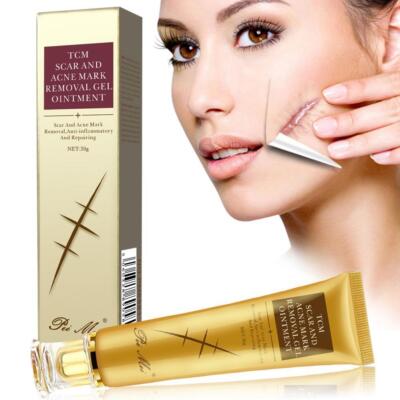  30g Acne Scar Removal Cream Pimples Stretch Marks Gel Nice Remove F1Y8