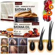 Natural Batana Oil Serum For Hair Growth Healthier Thicker Fuller Anti Hair Loss