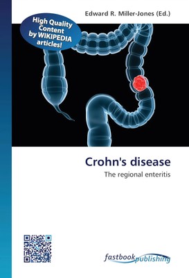 Edward R. Miller-Jones | Crohn's disease | Taschenbuch | Englisch (2012)