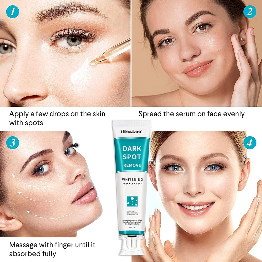 Best Whitening Freckle Cream Face Moisturizing Remove Dark Spots Melanin Melasma
