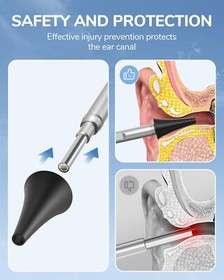 4.5-inch IPS Color Screen Digital Otoscope 1.0MP 1080P 3.9mm Camera 6 LED