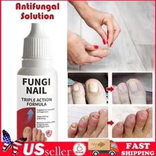 Fungi-Nail Anti-Fungal Liquid Solution Kills Fungus That Can Lead To Nail