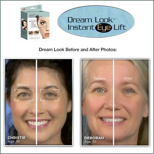 Dream Look Instant Eye Lift for Droopy, Saggying, or Hooded Eyelids - Image 2 of 4