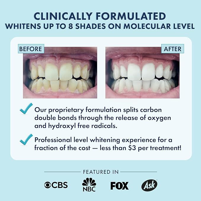 LivFresh Teeth Whitening Strips_14 Treatments_NEW & SEALED!!!