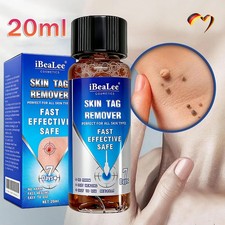 Warzen Entfernung Haut Tag Behandlung Wart Remover Warze Entferner Flüssige 20ml