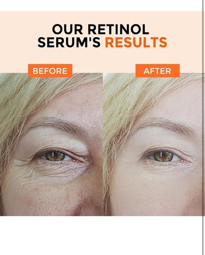 Retinol Serum for Face 2.5%, B5 Herbal Resurfacing Retinol Serum - Picture 5 of 6