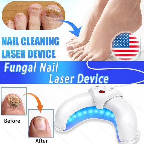 Nail Fungus Laser Device Light Therapy Onychomycosis Toes Treatment For Home US