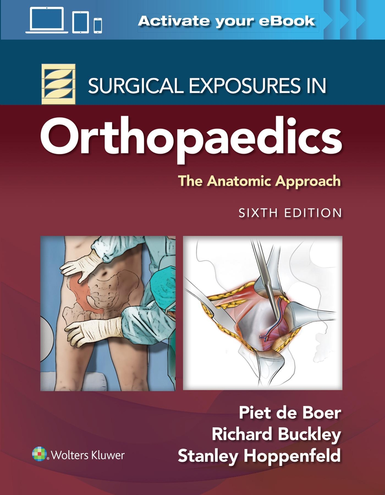 Surgical Exposures In Orthopaedics: The Anatomic Approach, Piet De