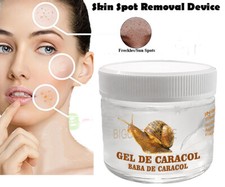 VITAMIN C WHITENING GEL CITRIC ACID FACE GEL CREAM REMOVE FRECKLE DARK SPOTS