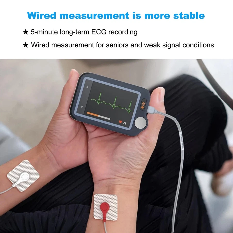Monitor de ECG con pantalla táctil Monitor cardíaco con cable de ECG Análisis AI-ECG a través de aplicación Foto 4 de 4