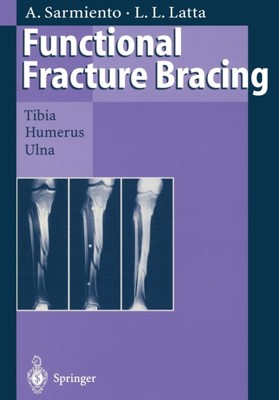 Sarmiento - Functional Fracture Bracing   Tibia Humerus and Ulna - N - X555z