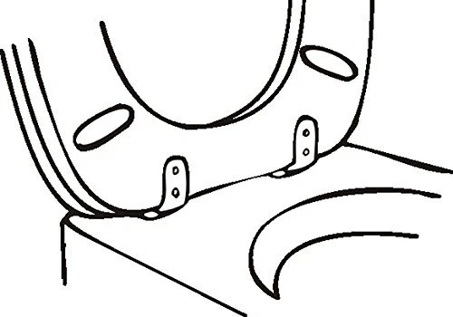 TEC365023 Puffersatz WC-Sitz Art of Acryl mit Absenkautomatik Weiss/opulenter... - Bild 3 von 3