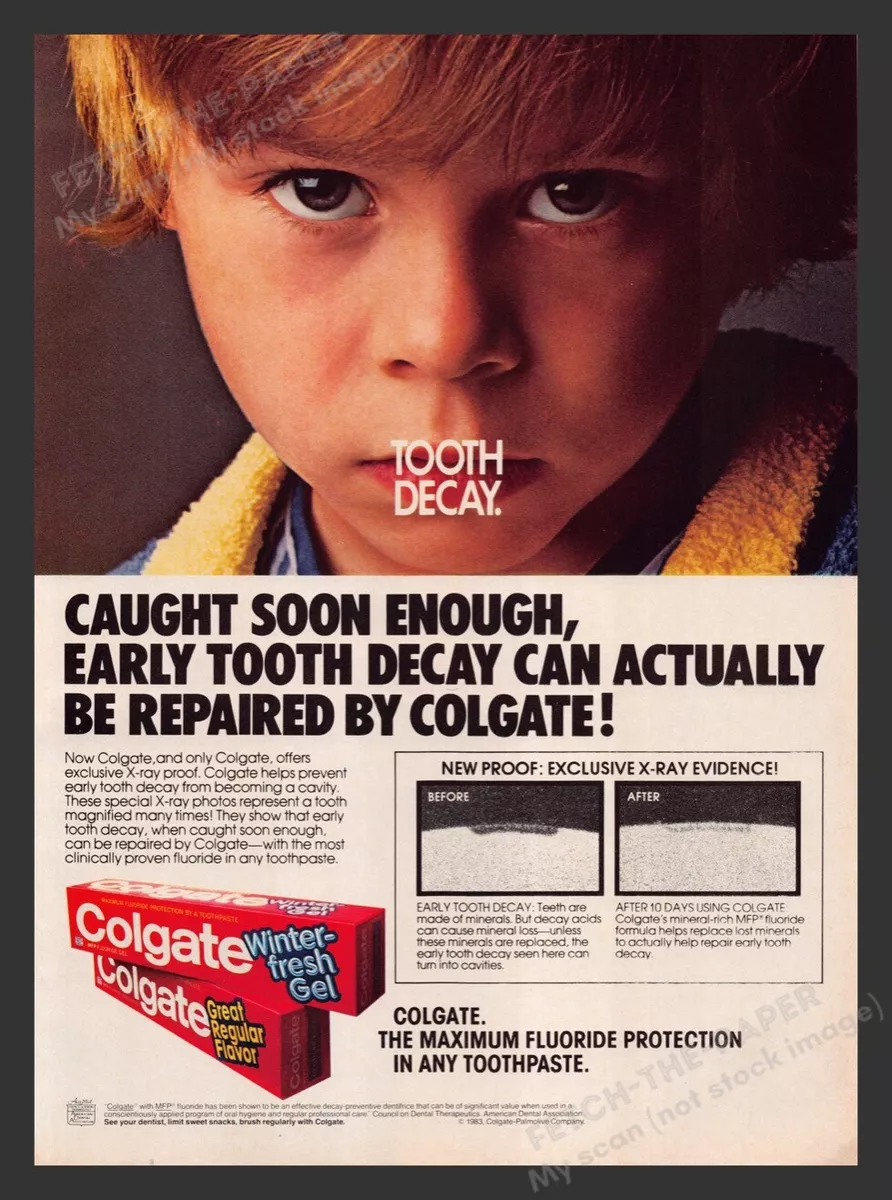 Colgate Toothpaste Tooth Decay Fluoride 1980s Print Advertisement