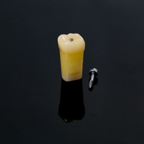 Kilgore Nissin Dental Vitro Dientes Caries Dientes Modelo Dentista Práctica R-28 - Imagen 25 de 26