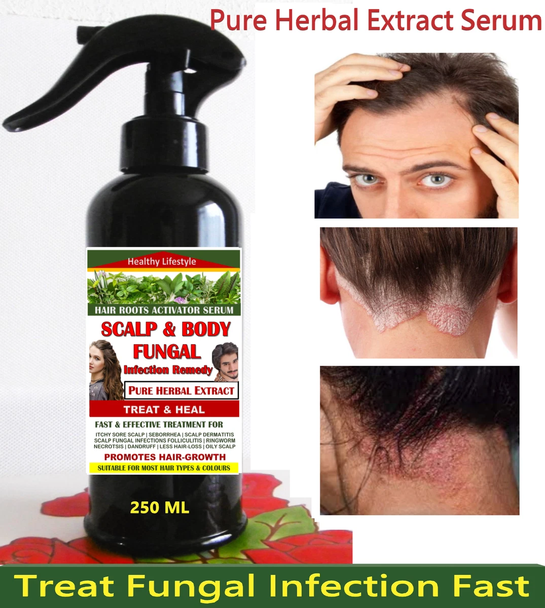 Is Engine Oil Good for Hair Dandruff?: Effective Remedies