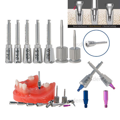 Implant Bone Profiler & Guide Screw - Ø4.0-6.0 Hiossen & OSSTEM fit Dental M6019