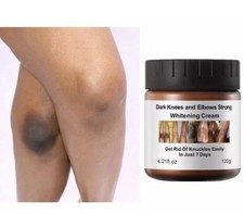 New Strong Whitening Cream For Removing Dark Knuckle Finger Elbow and Knee USA