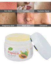 Crema Blanqueadora Para La Cara Acne Pecas Manchas Luce Una Piel Hermosa 50g