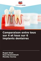 Comparaison Entre Tous Sur 4 Et Tous Sur 6 Implants Dentaires Rupal Shah (U. A.)