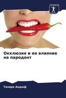Tahira Ashraf | OkklüZiq I Ee Wliqnie Na Parodont | Taschenbuch | Russisch