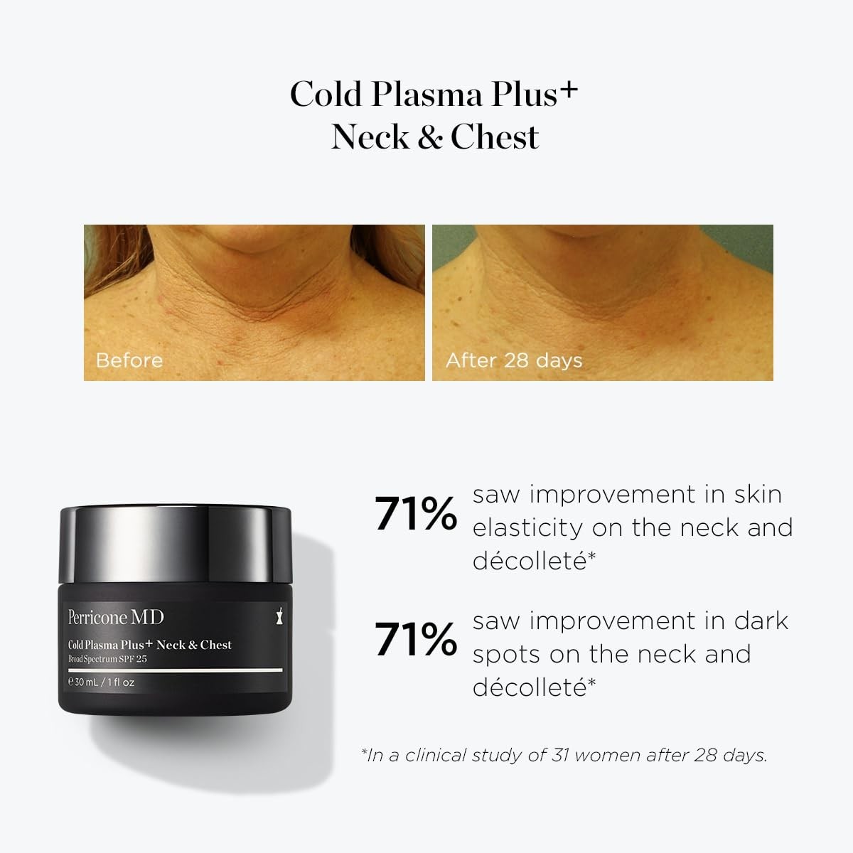 Perricone MD Cold Plasma Plus+ Neck & Chest 1 Fl Oz (Pack of 1), Off White  thumbnail 3