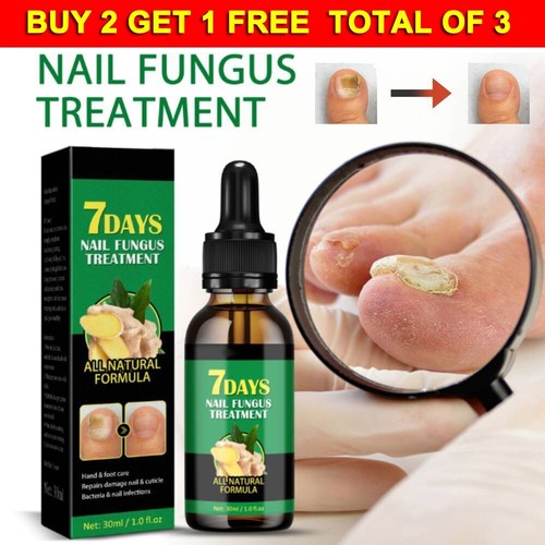 30ml 7 Days Nail Fungus Treatment All Natural Formula Gingers Nail Toenail Care