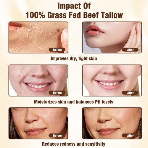 All-Natural Moisturizer: Grass-Fed Beef Tallow & Honey Balm for Dry Skin Relief - Picture 8 of 9