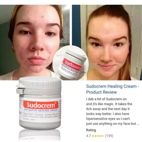 125g Sudocrem Antiseptic Healing Skin Cream- Nappy Rash, Acne, Eczema, Wounds - Picture 2 of 6