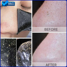 Blackhead Remover Strips Acne Mask Face Deep Cleansing Pore Peel Off Sticker