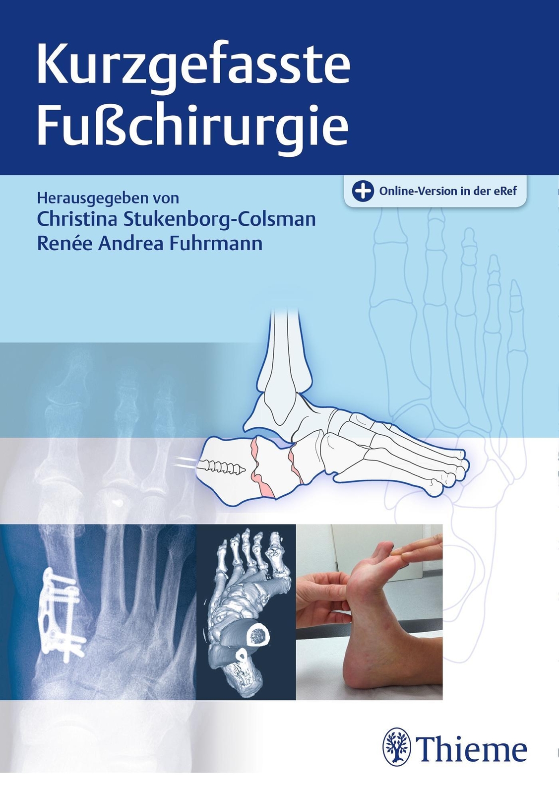 Thumbnail - Kurzgefasste Fußchirurgie | Christina Stukenborg-colsman (u. A.) |