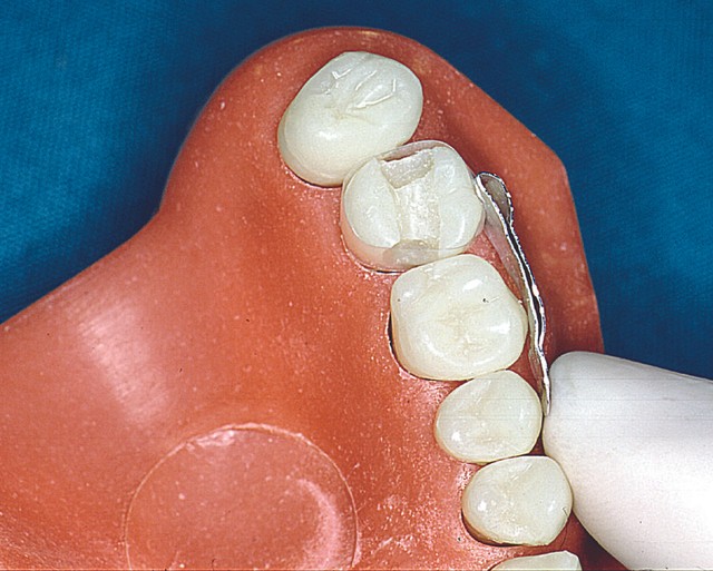 Dental SelfLocking Polyester Matrices 0.05mm thickness 40 pcs; Molar