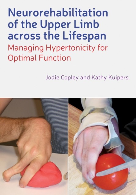 Neurorehabilitation of the Upper Limb Across the Lifespan: Manag - Image 3