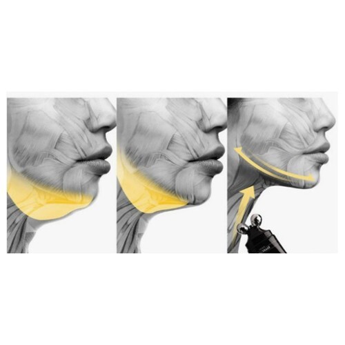 BRAVITY EFFECTRA MEDIC SHAPER | eBay