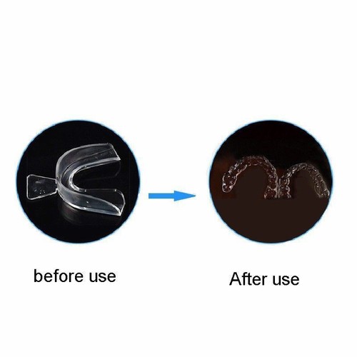 KIT SBIANCAMENTO DENTI 6x3cc SIRINGHE + 4 STAMPI DENTI + PENNA GEL + LUCE LASER - Foto 9 di 13