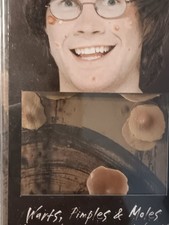 Don Post F/X Makeup Effects: Warts, Pimples,  Moles FX New on Rough Card