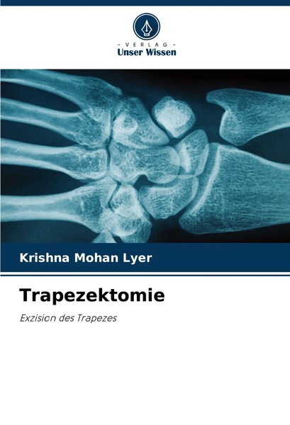 Krishna Mohan Lyer | Trapezektomie | Taschenbuch | Deutsch (2024) | 60 S.-image