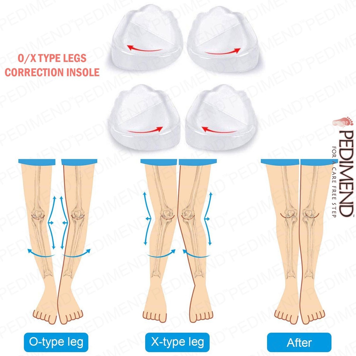 PEDIMEND™ Supination and Pronation Corrective Heel Insoles O/X