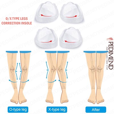PEDIMEND  Supination and Pronation korrigierende Ferseneinlegesohlen - O/X-Typ Beineinlegesohle