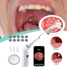 Visible Tonsil Stone Removal Kit with HD Camera Electronic Tonsil Stone Remover