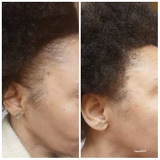 Organic  Hair Growth Oil Serum DHT-Alopecia-Thinning Hair-Balding (60ml) 