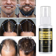 5% Minoxidil for Men Hair & Beard Growth Serum Spray Hair Loss 1 Month Supply