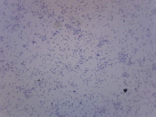 10PK Clostridium Botulinum, Gram-Positive - Prepared Microscope Slides - Classro