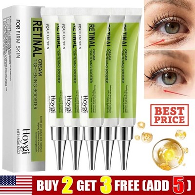 Retinol Eye Cream, Eye Bags Removal To Fight Fine Lines, Wrinkles & Dark Spots
