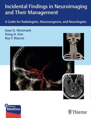 Incidental Findings in Neuroimaging and Their Management Kaye D. Westmark