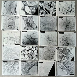 Vintage Transmission Electron Micrographs TEM Photos Scientific Ephemera Lot 20