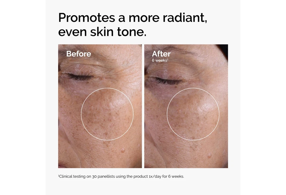 Tónico ácido glicólico ordinario 7 % - Exfoliante iluminador - 240 ml Foto 2 de 4