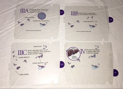 OVARIAN CANCER 3-D MODEL Female Uterus Vagina Cervix Anatomical Teaching OB GYN - Picture 6 of 6